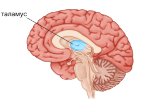 Что представляет собой таламический инсульт: последствия, лечение и восстановление?