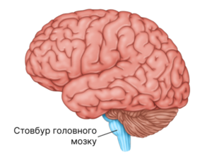 Инсульт ствола мозга: как он влияет на организм и чего ждать