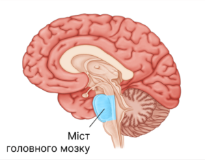 Понимание инсульта моста головного мозга: обзор симптомов, последствий и процесса восстановления